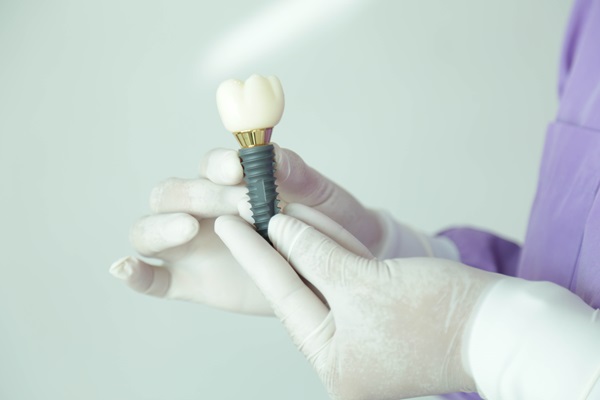 Making Your Implant Crowns Last